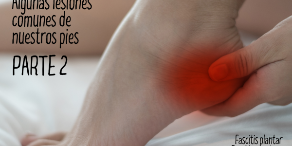 Algunas lesiones comunes de nuestros pies. Parte II