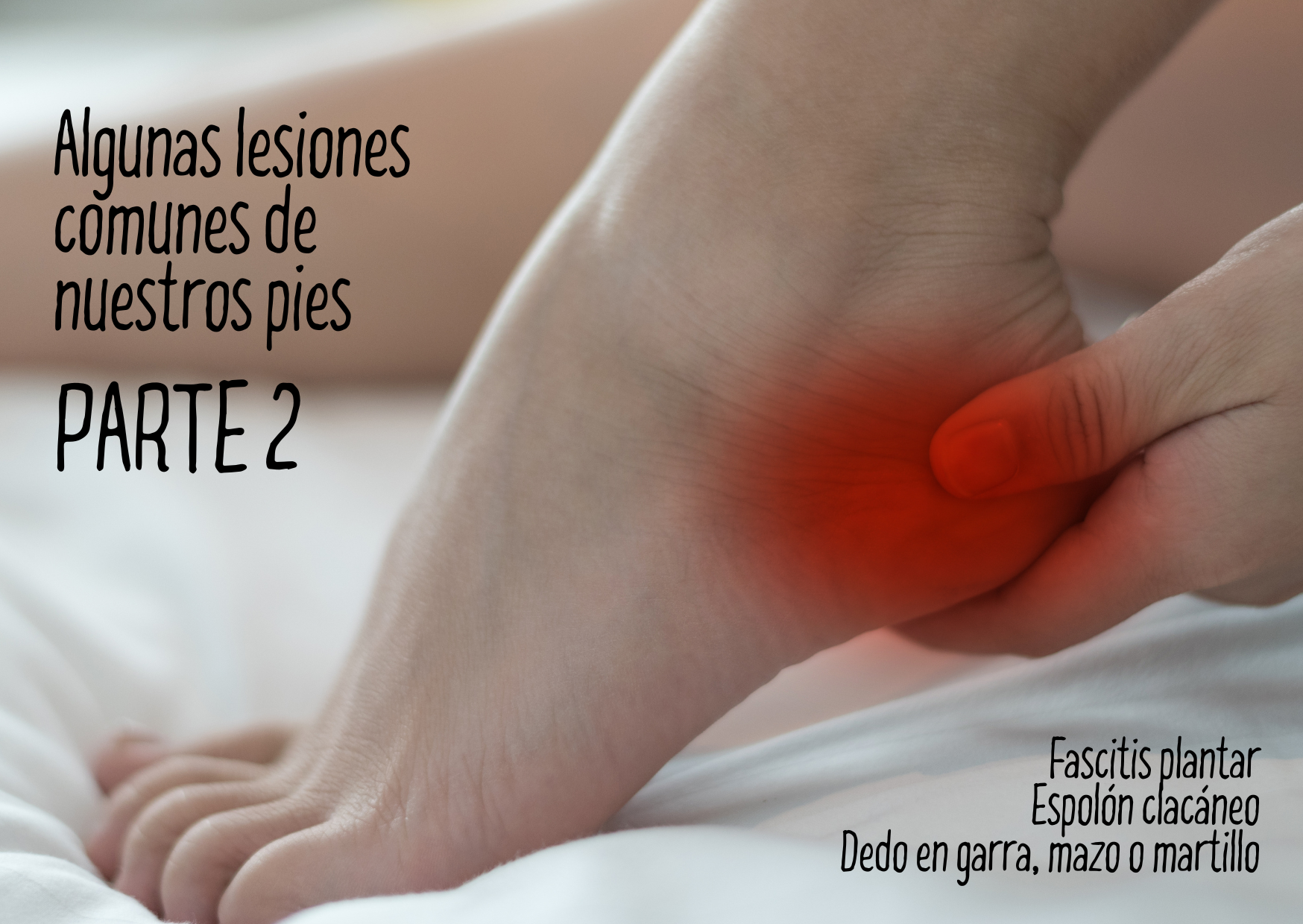 Algunas lesiones comunes de nuestros pies. Parte II